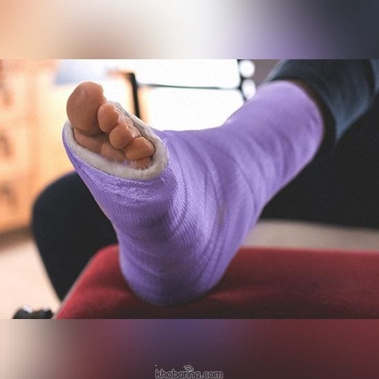 تعبیر خواب شکستن پا